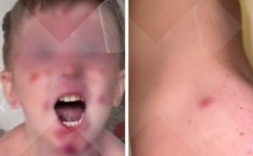 «Ничего не помогает»: российская семья заразилась загадочной болезнью на Бали — БлокнотРУ — Блокнот новости России. Блокнот Россия. Блокнот новости России и мира сегодня. Россия последние новости на сегодня. Новости России. Блокнот России. Россия новости. Новости Россия. Россия новости сегодня.